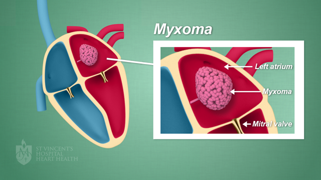 Myxoma with watermark image