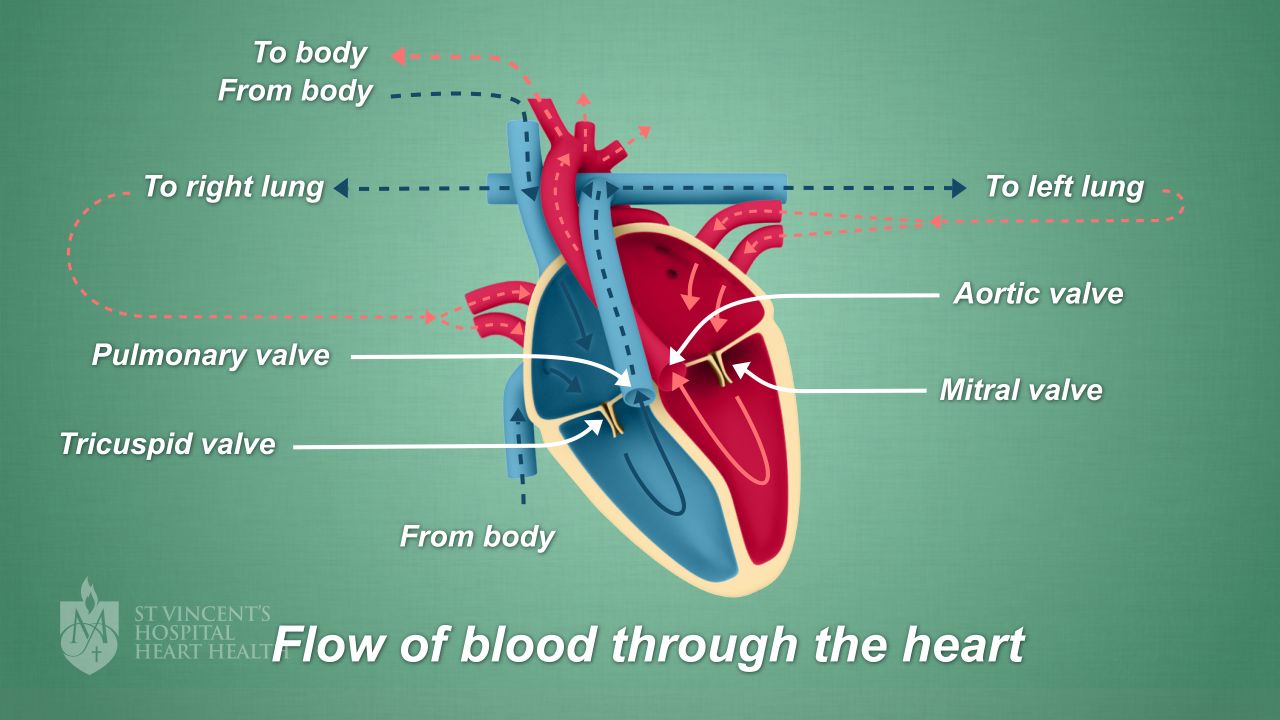 Heart Valve Surgery - "Valve Surgery" - St Vincent's Heart Health