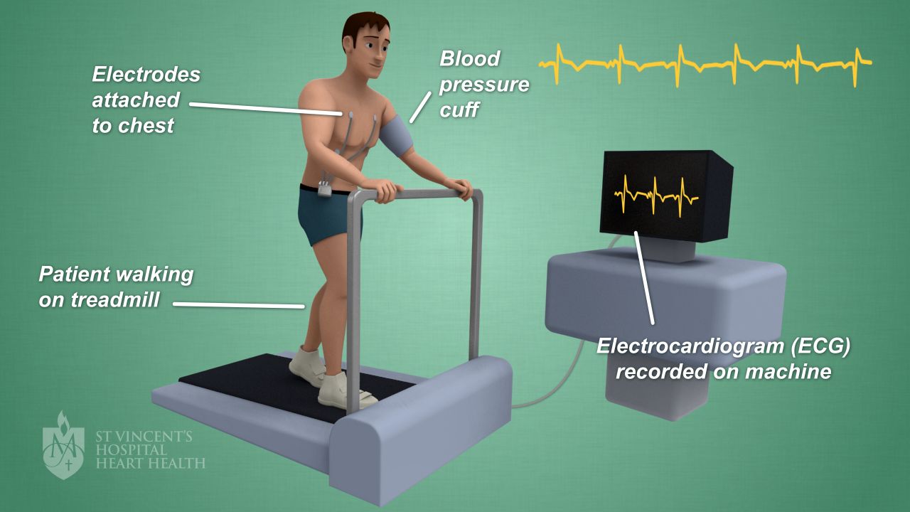 Stress Test Heart Rate Chart